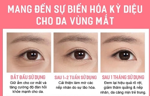 Kem Giảm Thâm Mắt Collagen 701