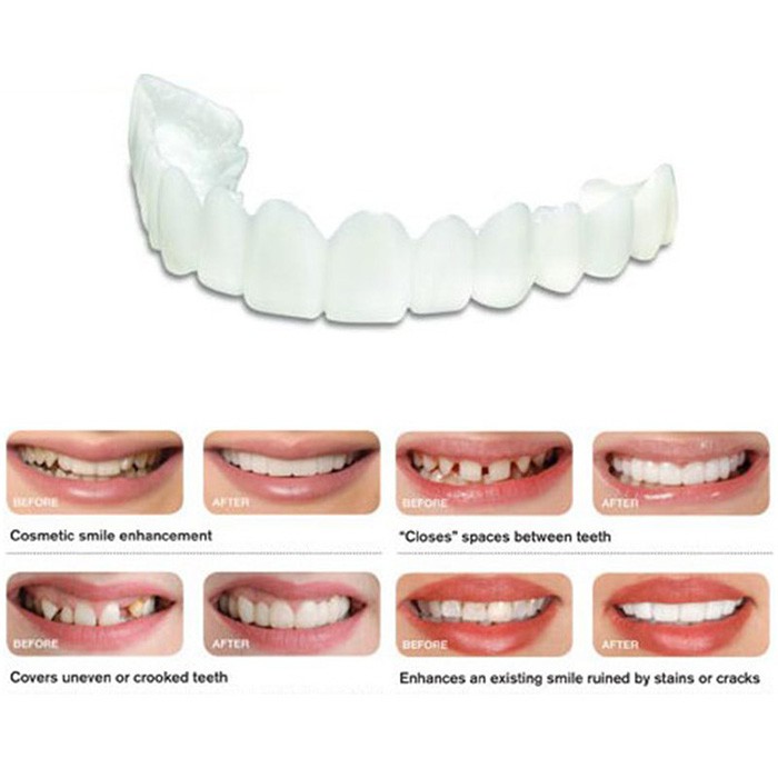 False teeth snap on smile kmdeal