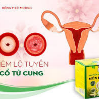 Viên Đặt XM