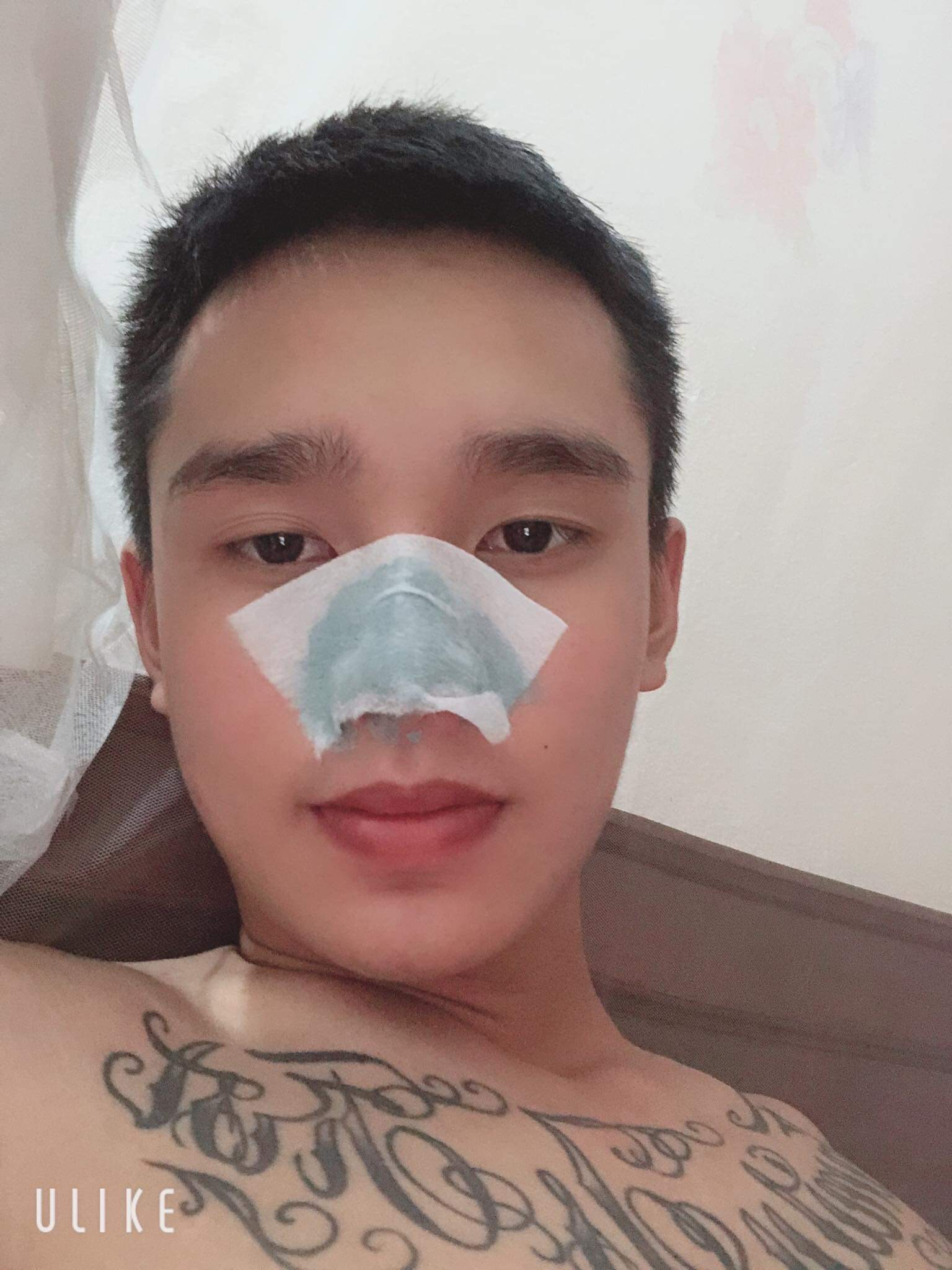 Gel lột mụn đầu đen mụn cám acne