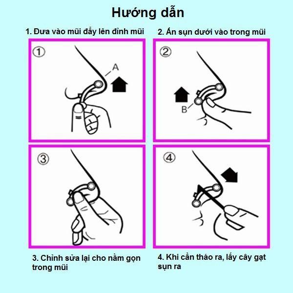 [HCM]Sụn nâng mũi 3D Hàn Quốc