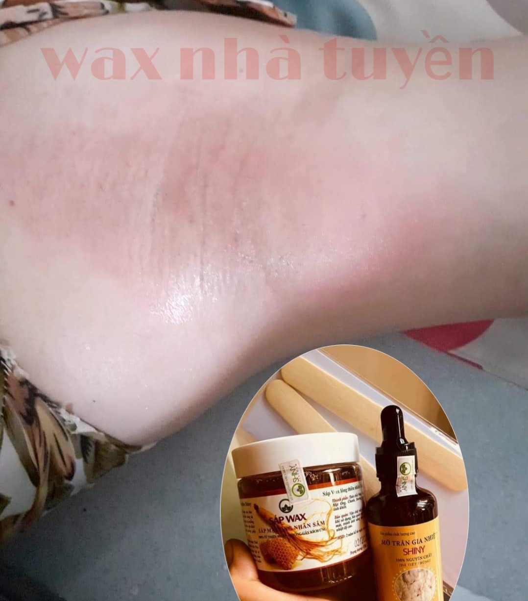 wax triệt lông