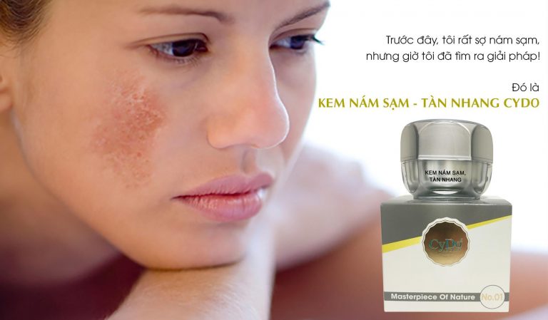 Kem cydo luxury nám sạm tàn nhang