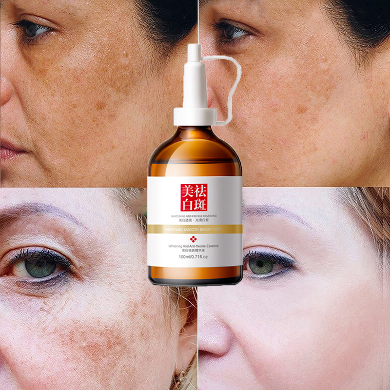 100ml Tinh chất dưỡng trắng serum Xóa nám nhanh chóng Tinh chất dưỡng ẩm dưỡng trắng sáng da loại bỏ nếp nhăn và nám thu nhỏ lỗ chân