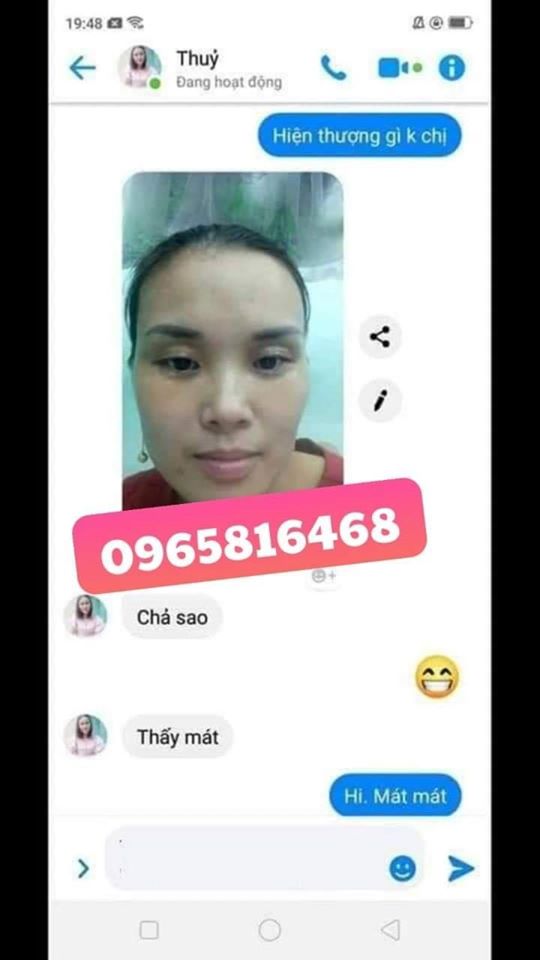 KEM XÓA MỤN THỊT - BỌNG MẮT - QUẦNG THÂM MẮT