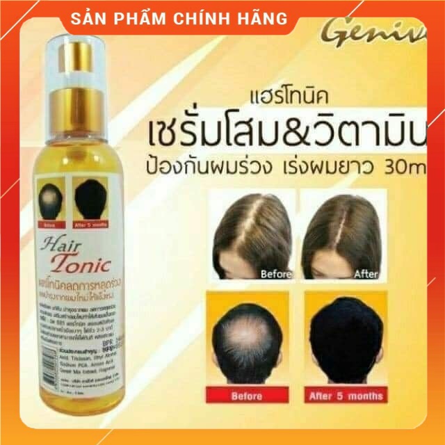 (Chính Hãng) Xịt Kích Mọc Tóc Genive Hair Tonic 120ml Giảm Rụng Tóc Nhiều , Hối Đầu Hiệu Quả