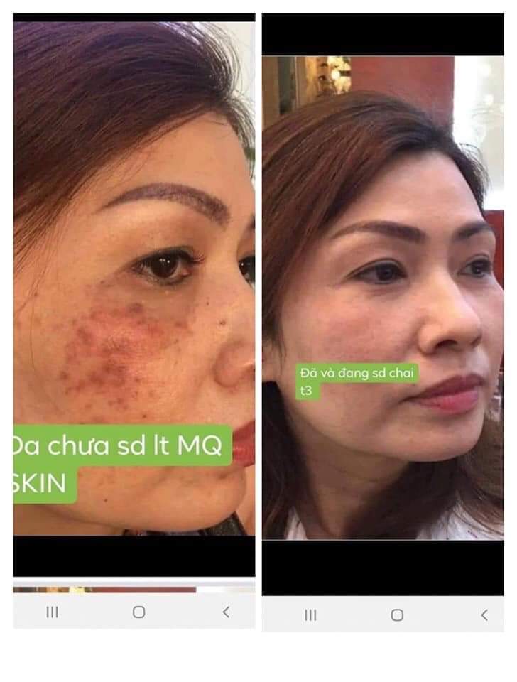 SERUM TÁI TẠO DA NHÂN SÂM MQ-SKIN ( chính hãng )