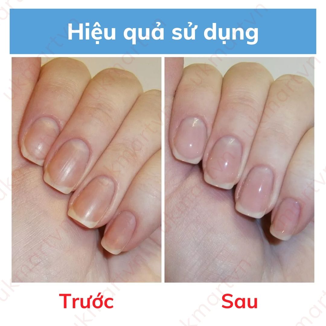 Sơn Dưỡng Móng Eveline 8w1 Total Action 12ml