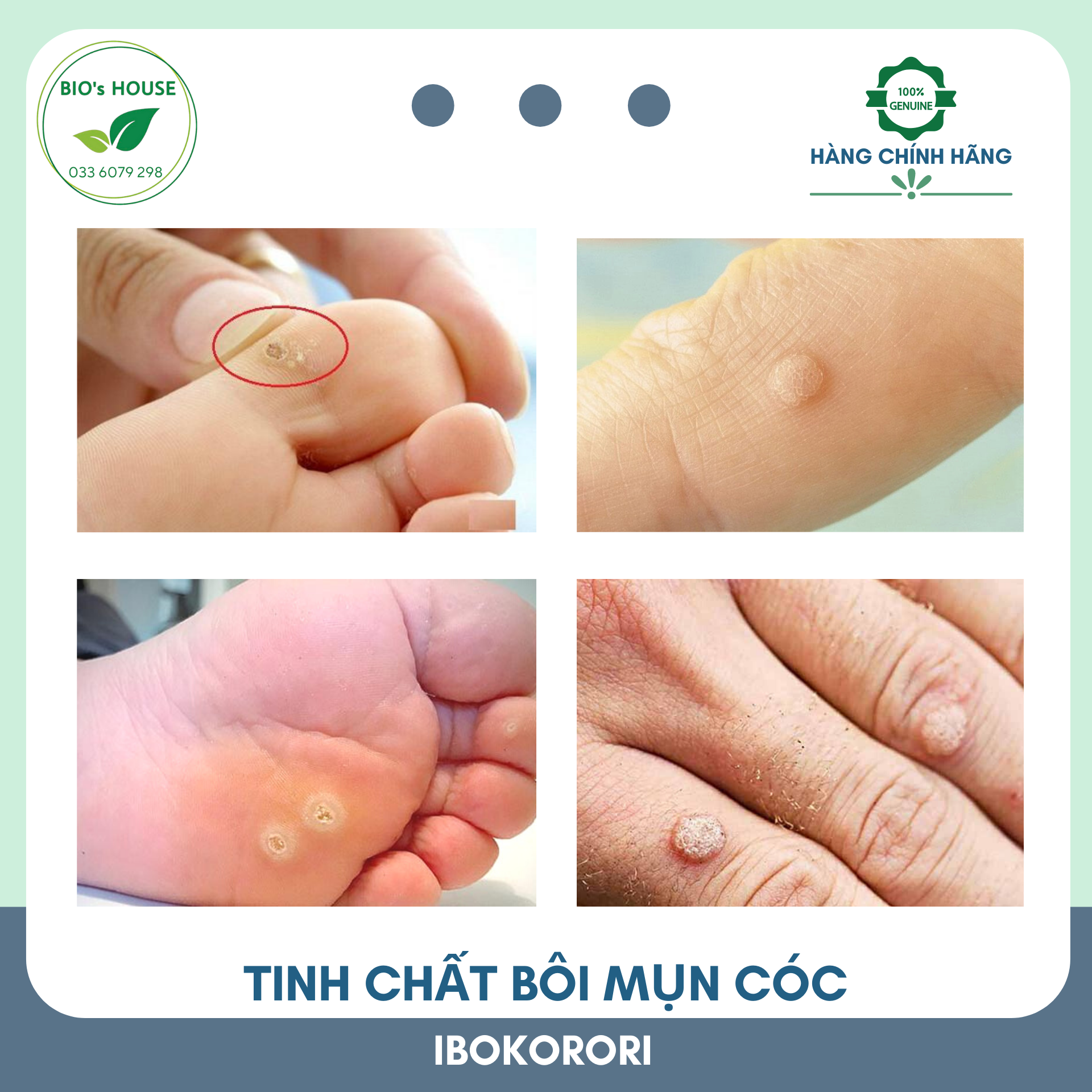 Tinh chất bôi mụn cóc IBOKORORI 10ml (Nhật Bản)