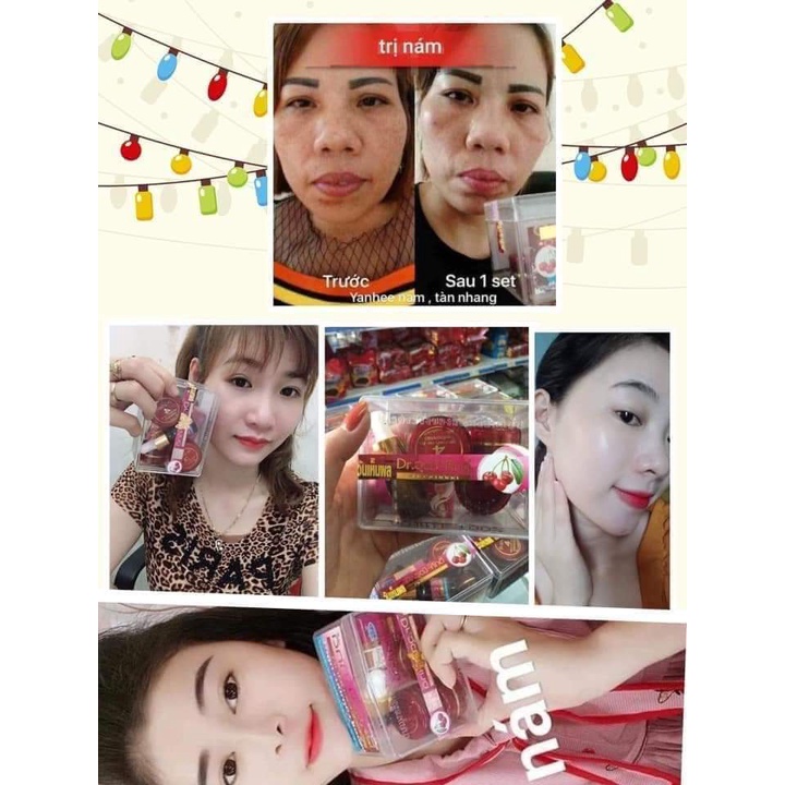 [ HÀNG CHUẨN ] SET KEM NÁM TÀN NHANG YANHEE ĐỎ THÁI LAN
