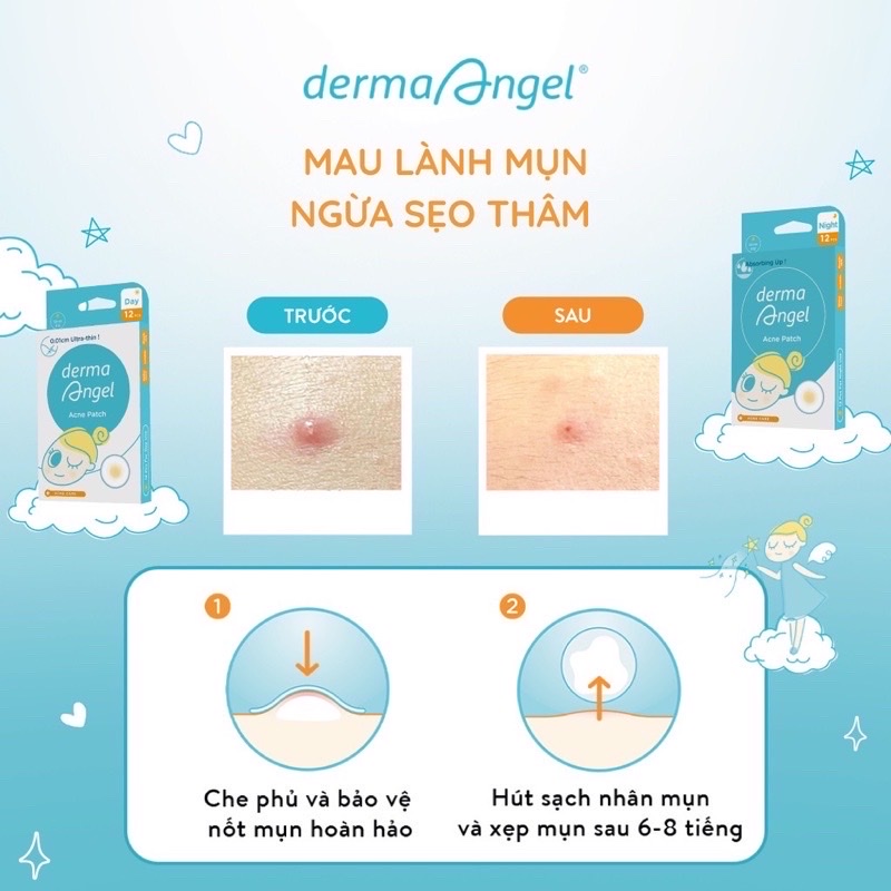 Miếng Dán Mụn Derma Angel Patch