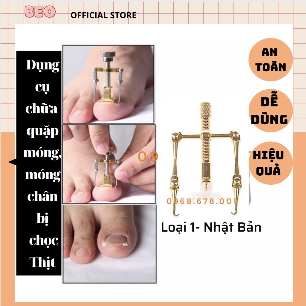 dụng cụ chữa quặp móng chân khỏi đau do móng đâm vào thịt