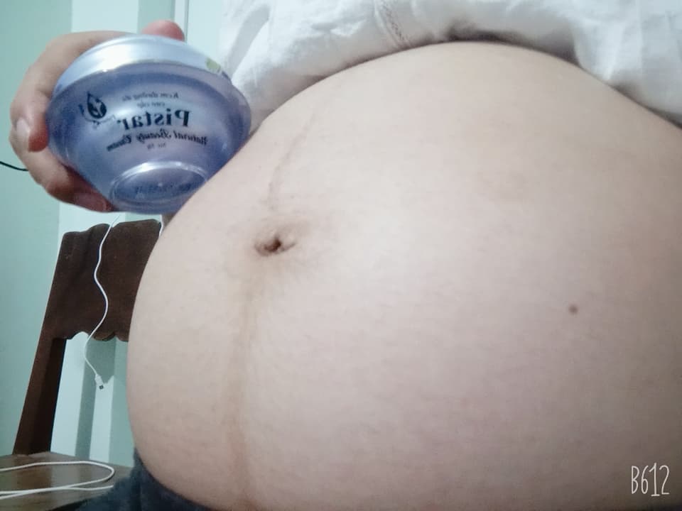[HCM]KEM NGỪA RẠN DA CHO BÀ BẦU-PISTAR