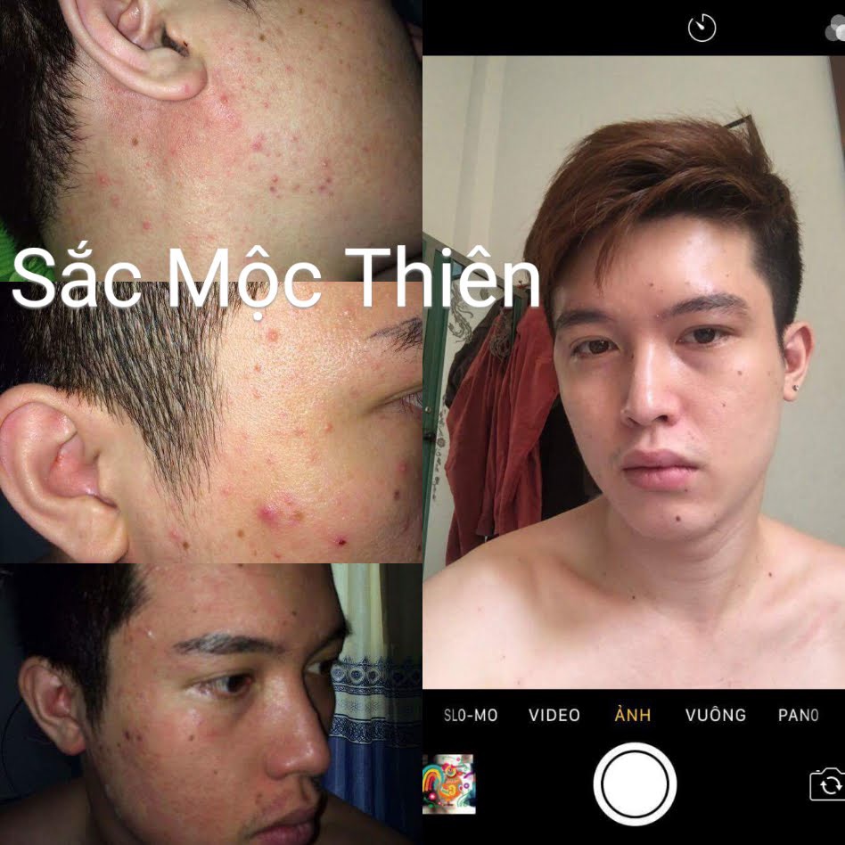 Sắc Mộc Thiên Cao Cấp 30ml