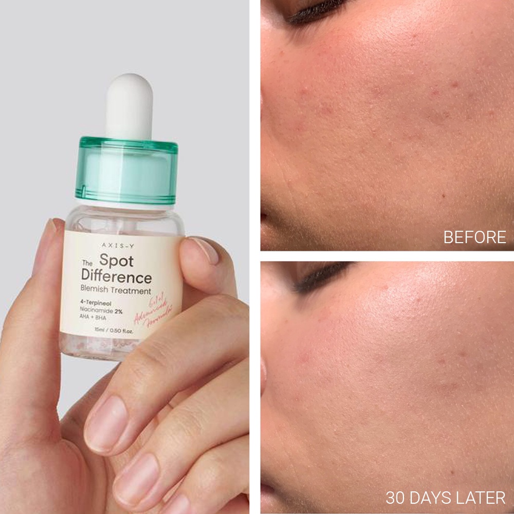 Tinh Chất Giảm Mụn, Mờ Thâm AXIS-Y Spot The Difference Blemish Treatment
