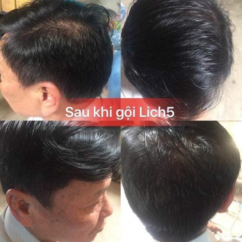 Combo Dầu gội phủ bạc Lich5 + Dầu gội đen tóc hà thủ ô [cặp đôi hoàn hảo cho ng tóc bạc]