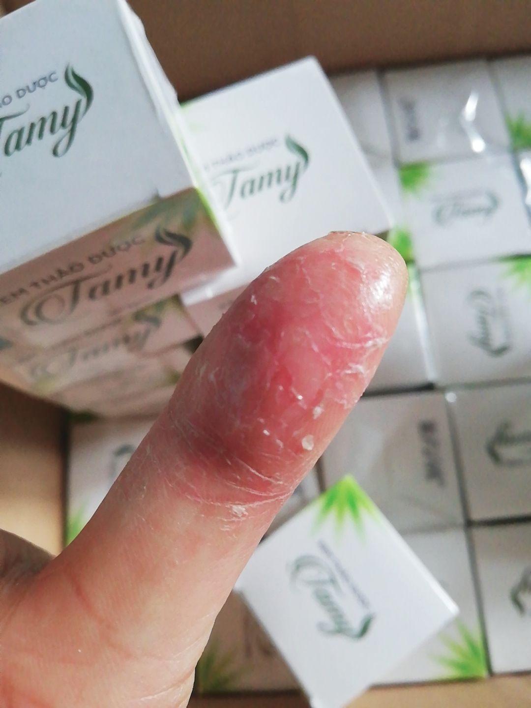 Kem thảo dược Tamy