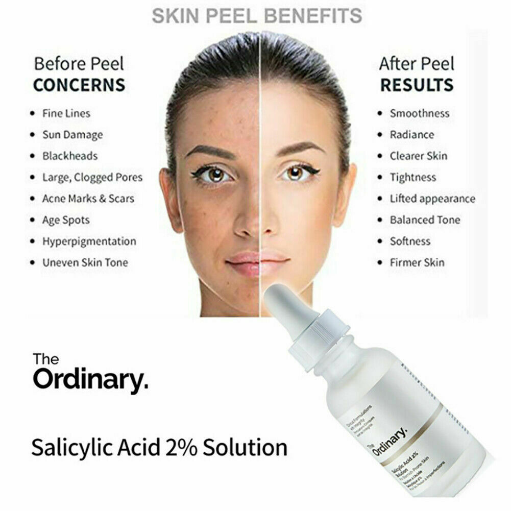 Serum Cải Thiện Thâm Mụn  The Ordinary Salicylic Acid 2% Solution