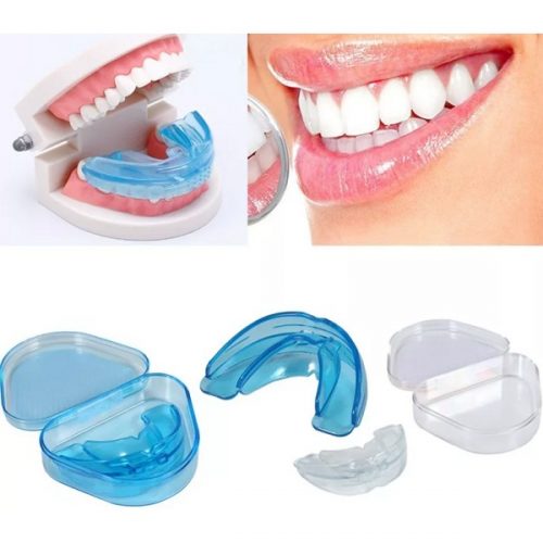 Dụng Cụ Niềng Răng Tại Nhà