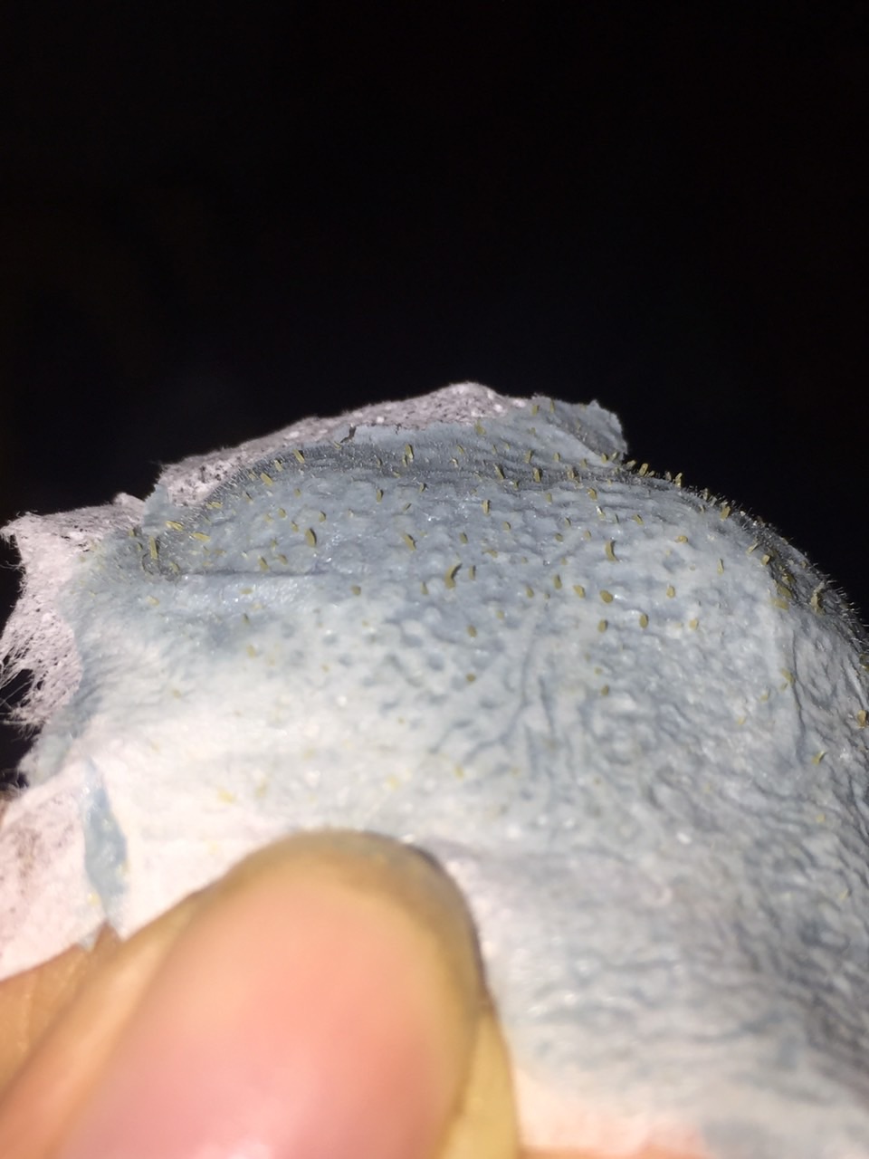 Gel Hút Mụn ( Combo 5 hộp )