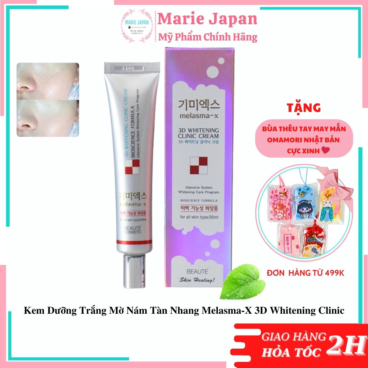 Kem Dưỡng Trắng Mờ Nám Tàn Nhang Melasma-X 3D Whitening Clinic