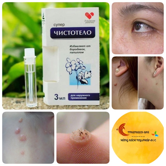 Gel tẩy mụn thịt mụn cóc mục ruồi