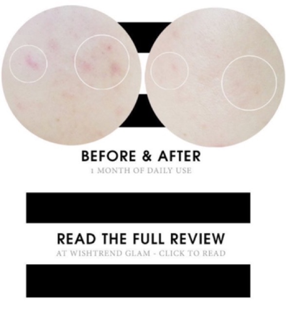 TẨY DA CHẾT HOÁ HỌC COSRX BHA BLACKHEAD POWER LIQUID