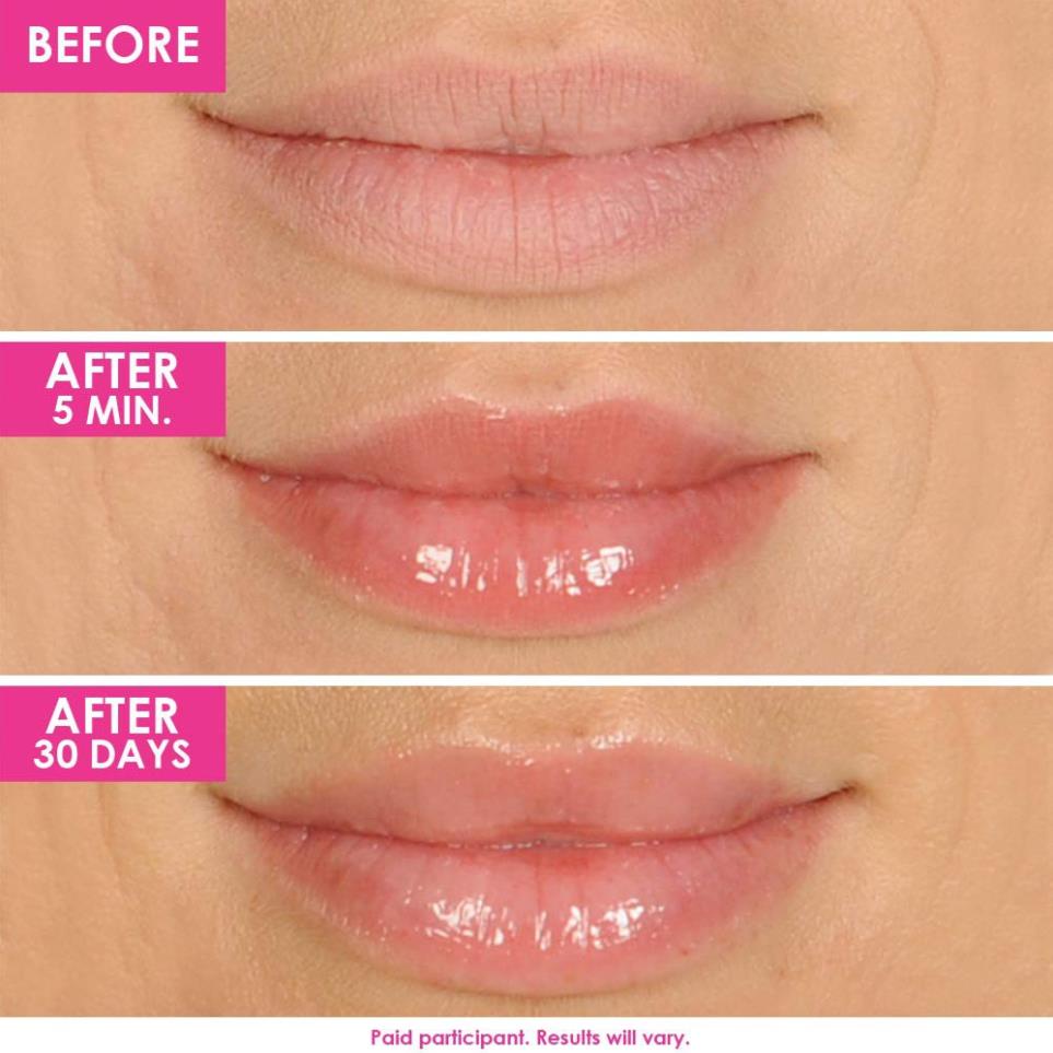 Son Dưỡng Môi GrandeLips Hydrating Lip Plumper