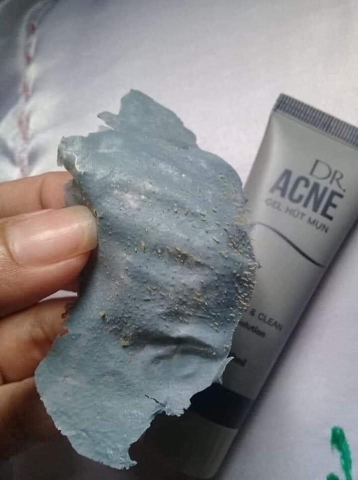 (COMBO 10 HÔP) Lột mụn đầu đen acne