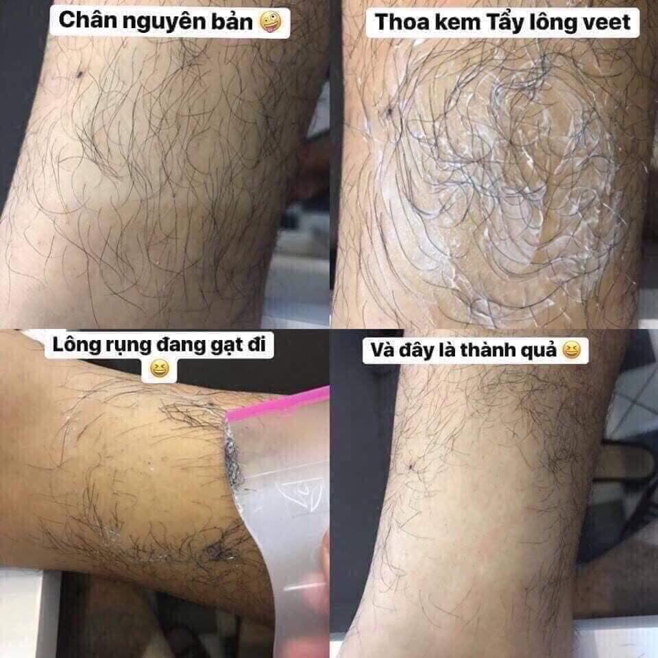 Kem Tẩy Lông Veet 100ml (Hồng - Xanh)