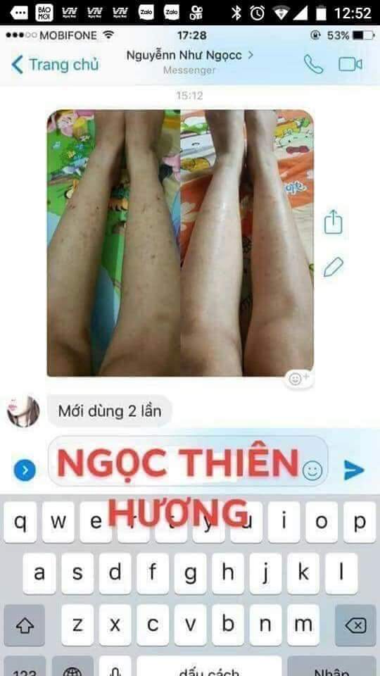Serum tri thâm Ngọc Thiên Hương