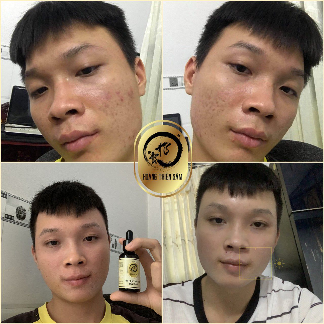 COMBO Tái Tạo Hoàng Thiên Sâm