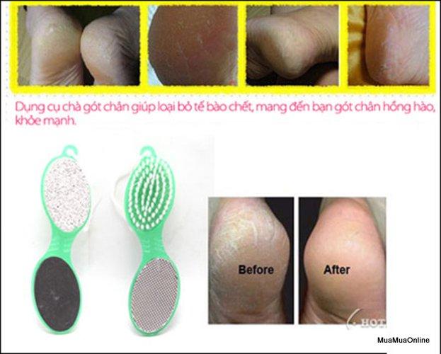 Đá Bọt Biển Chà Gót Chân 4 Trong 1 Cao Cấp