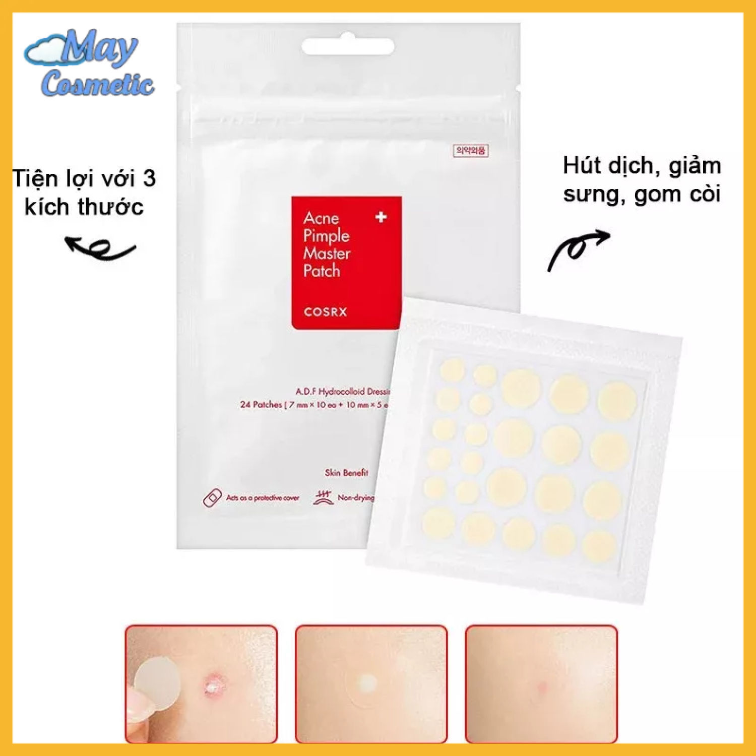 CosRX [original] pimple suction sticker acne extractor suction super effective acne (fit) pimple master patch