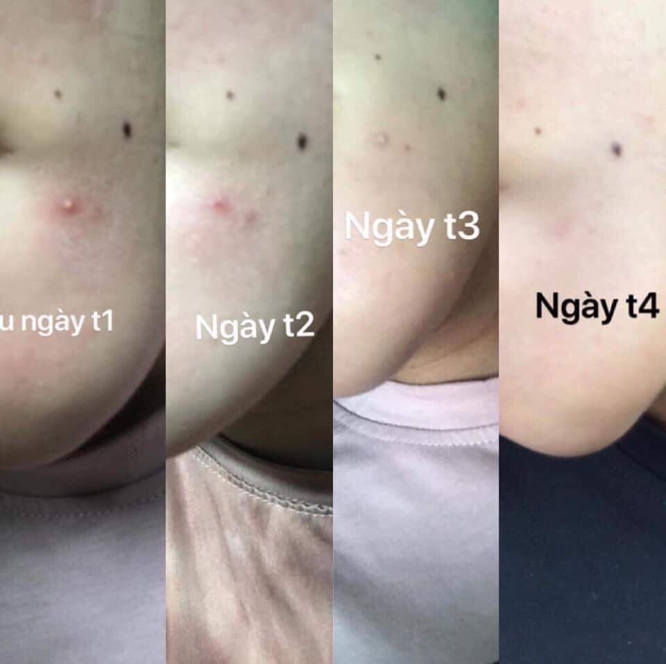 THANH LĂN NGỌC SÂM MINI 10ML CHÍNH HÃNG