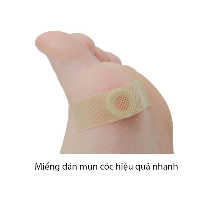 Set 15 Miếng dán mụn cóc hiệu quả nhanh dễ sử dụng