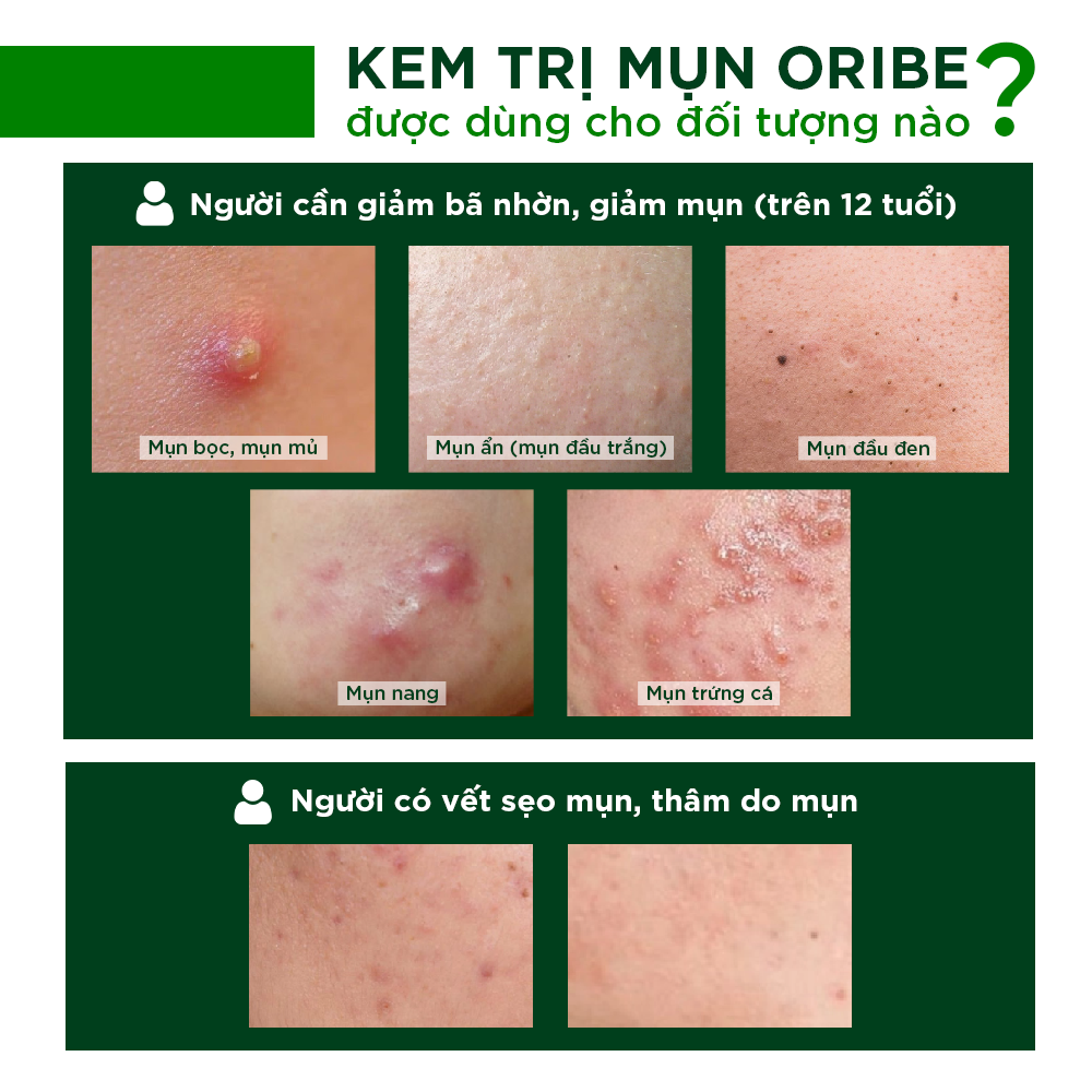 Bộ đôi cấp ẩm làm sạch dịu nhẹ phù hợp da mụn nhạy cảm Oribe Soft Touch (Gel rửa mặt 100gr + Nước hoa hồng 150ml)