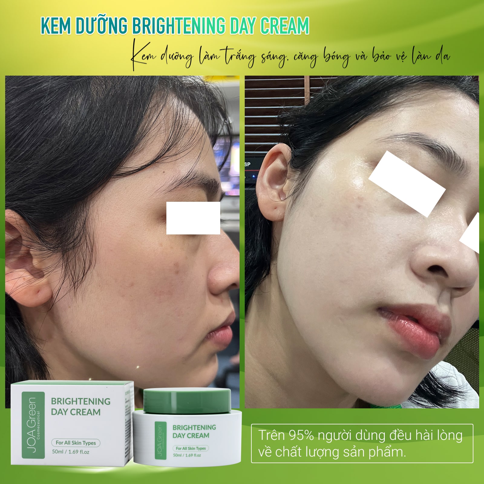 [COMBO THĂNG HẠNG NHAN SẮC] Giúp Phục Hồi, Dưỡng Trắng Da (Tặng 1 Tẩy Tế Bào Chết MS 100ml) - Mỹ Phẩm MS COSMETIC