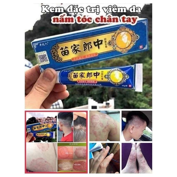 combo 2 tuýp kem bôi da