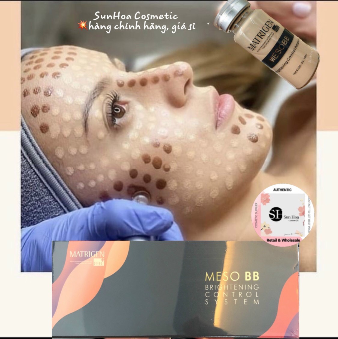 Cấy Phấn Trắng Da Hàn Quốc-Meso BB Brightening Control System