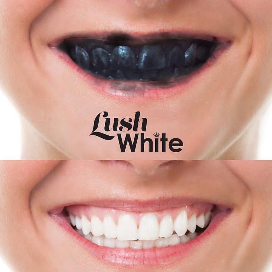 Viên đánh trắng răng Lush - Boom Toothy Tabs