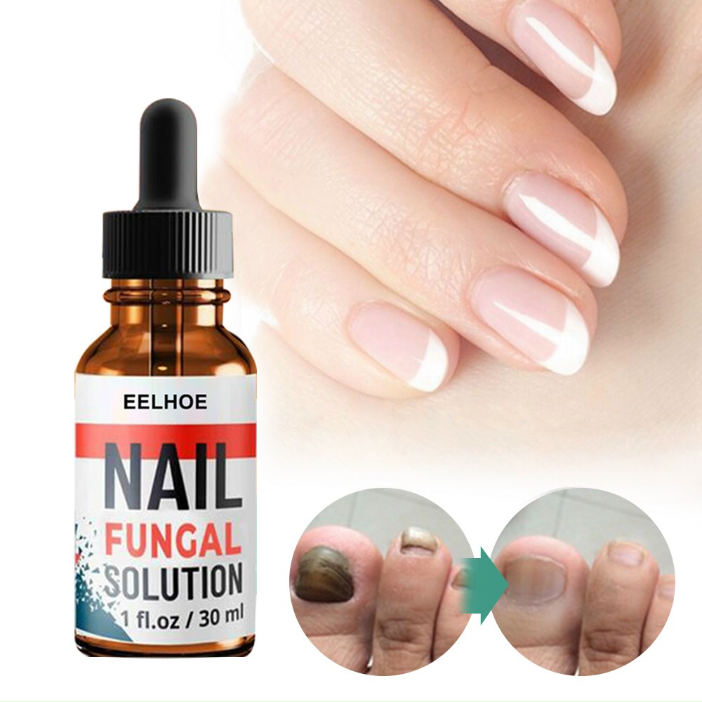 Serum trị nấm móng dưỡng móng phục hồi móng hư tổn