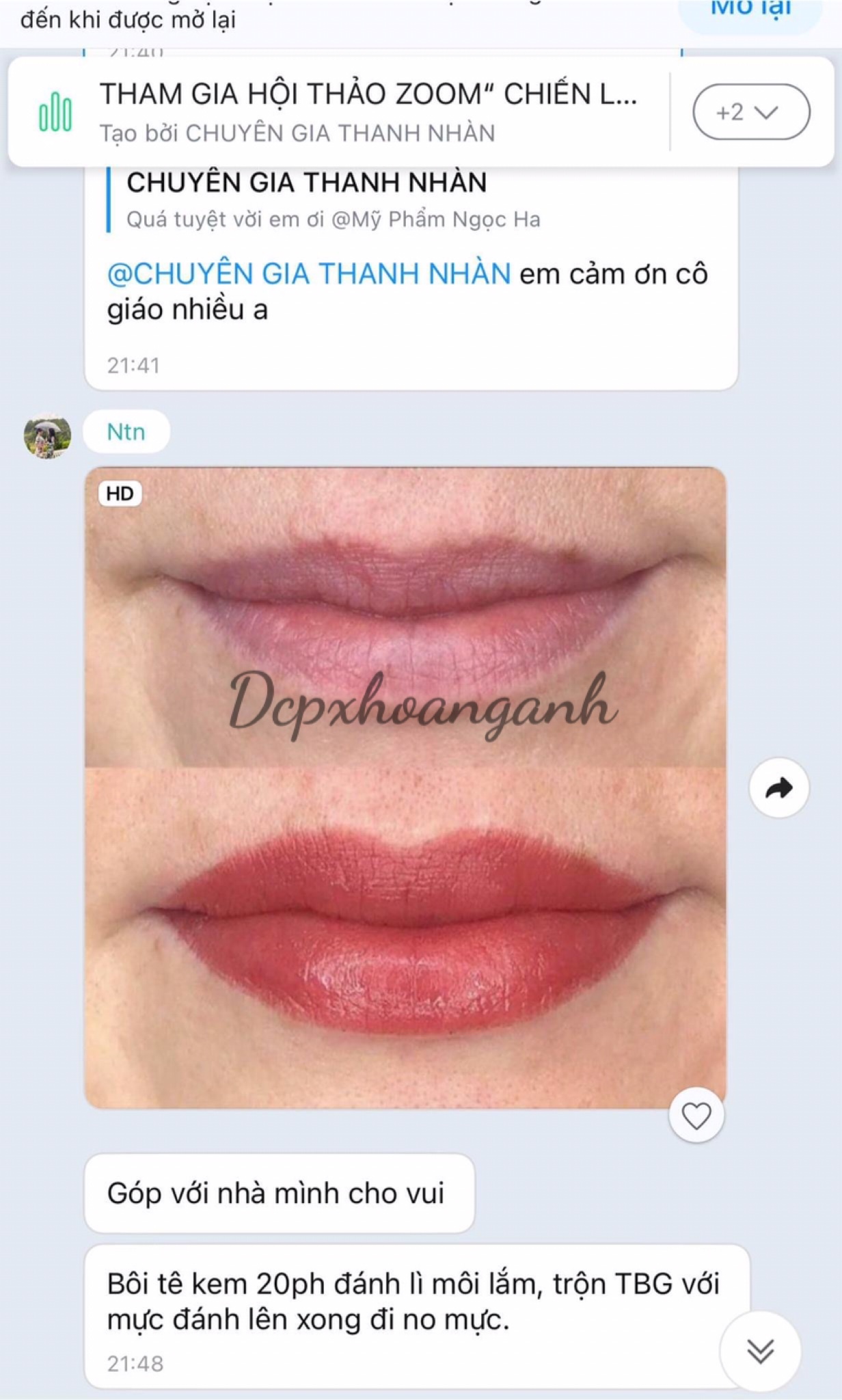 Dưỡng Tế Bào Gốc Stem Cell Serum - Dcpxhoanganh