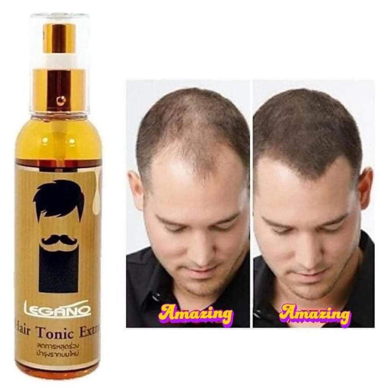 Xịt mọc tóc legano hair tonic extra 120ml chính hãng - 9031 - sản phẩm rất chất lượng, shop chọn lọc kĩ trước khi đến tay khách hàng, hàng chuẩn đảm bảo được ưa chuộng trên thị trường