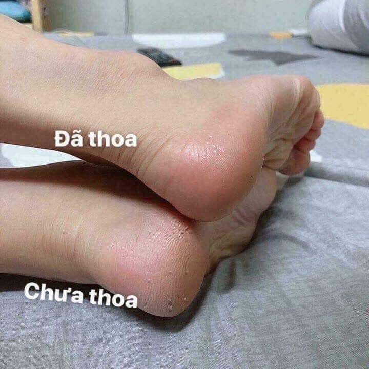 Kem chuối xóa nứt gót chân Thái Lan