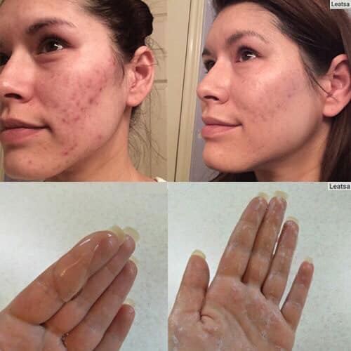 Sữa rửa mặt Novosvit Ốc sên trẻ hoá da (dạng gel)