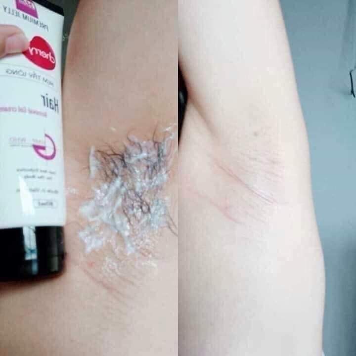 Kem TRIỆT LÔNG Cherry Mwhite - TRIỆT SẠCH MỌI LOẠI LÔNG [MUA 5 CHAI TẶNG KÈM MẶT NẠ DƯỠNG DA]