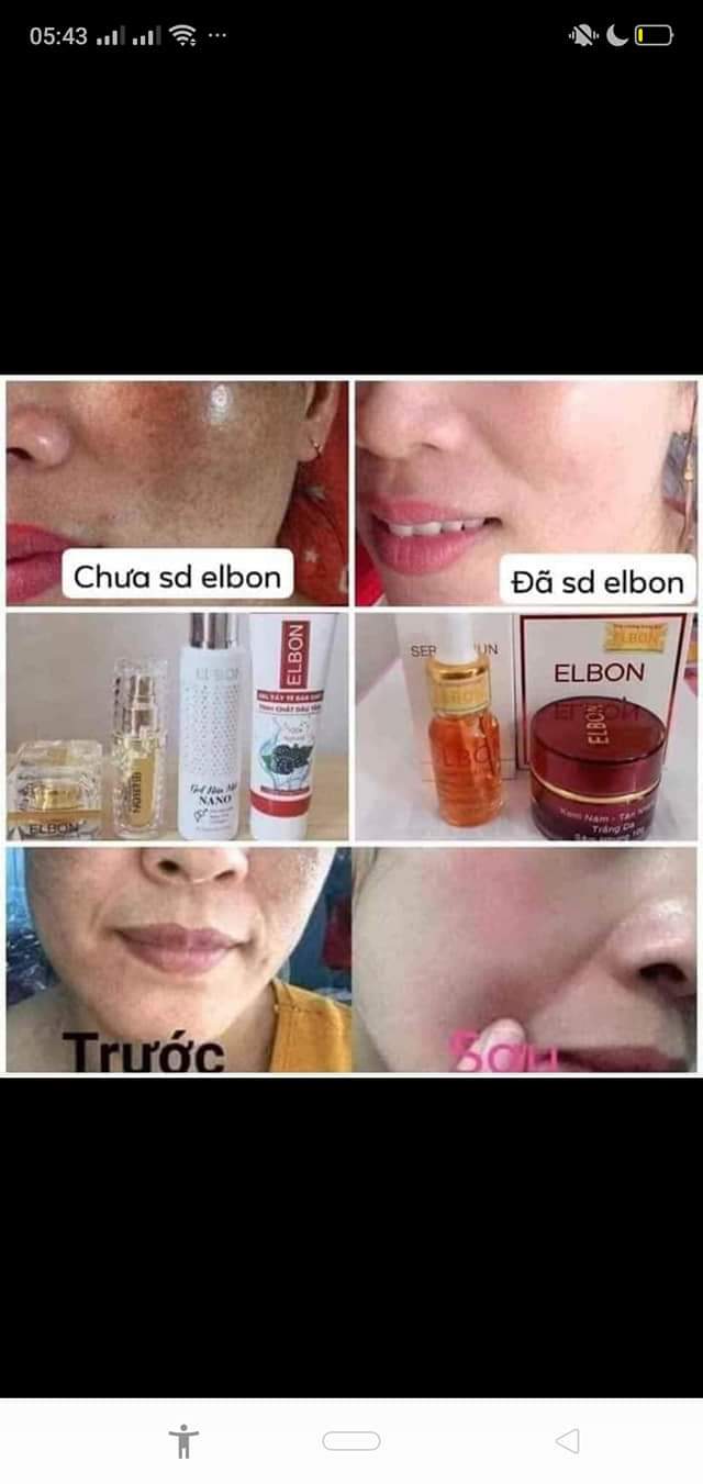 Kem nám tàn nhang trắng da sâm nhung elbon