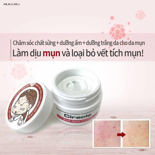 Kem Chấm Mụn Sưng Đỏ Ciracle Red Spot Cream