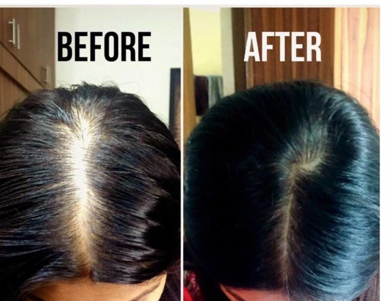 Xịt mọc tóc bưởi xanh